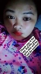 the things that almlost killed me