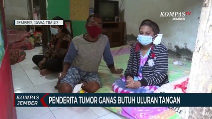 Warga Miskin di Jember Menderita Tumor Ganas Butuh Uluran Tangan