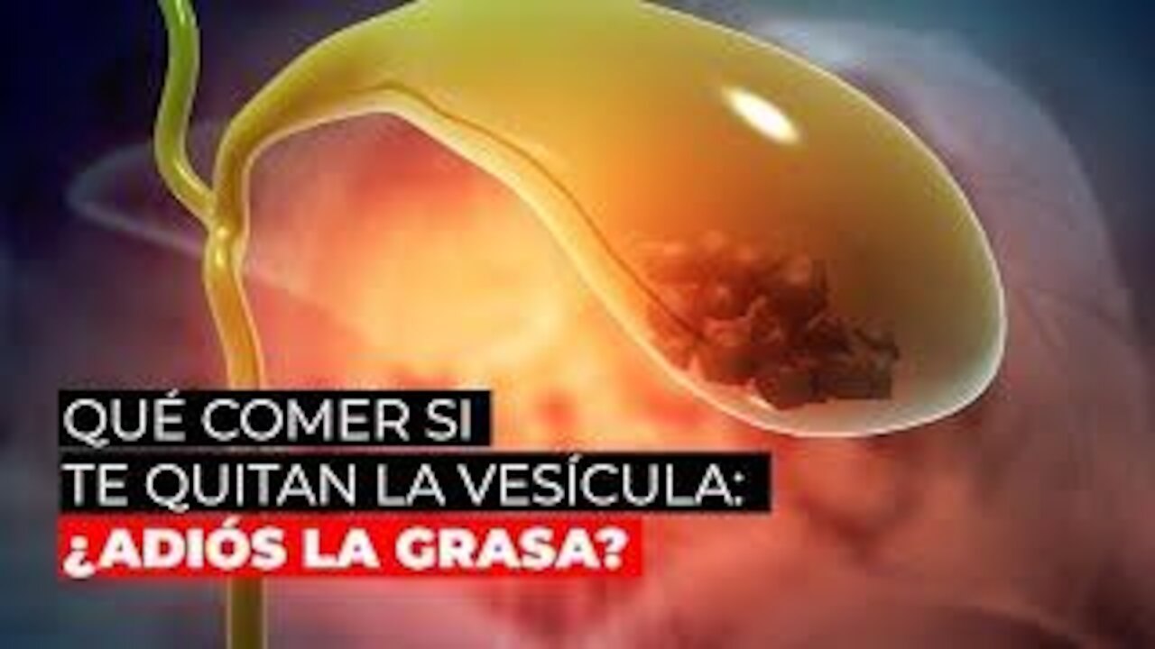 Qué comer si te quitan la vesícula ¿adiós a la grasa?
