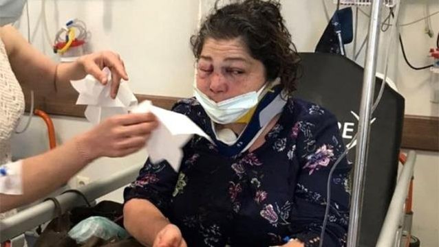 Belediye başkanının yanındakiler kadını darbetti, başkan kendini düşmüştür diye savundu