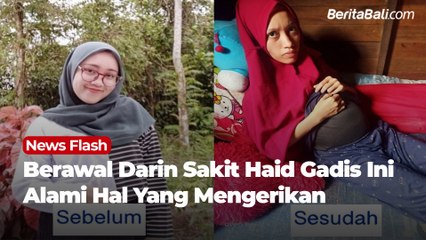 Berawal Dari Sakit Haid Gadis Ini Alami Hal Yang Mengerikan