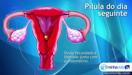 Pílula do dia seguinte: aprenda a usar o contraceptivo de emergência