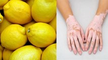 Skin पर Lemon लगाना हो सकता है खतरनाक , इस्तेमाल से पहले जान लें Side Effects । Boldsky