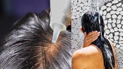 Baal Jhadne से रोकेगा जबरदस्त प्याज और चावल का Hair Tonic | Boldsky