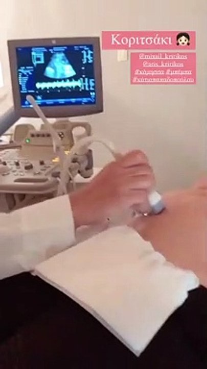 Κρητικός – Παπαδοπούλου: Αυτό είναι το φύλο του μωρού που περιμένουν