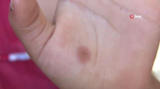 Avcılar'da sivrisinek kabusu büyüyor