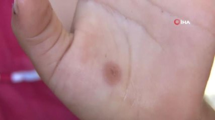 Avcılar'da sivrisinek kabusu büyüyor