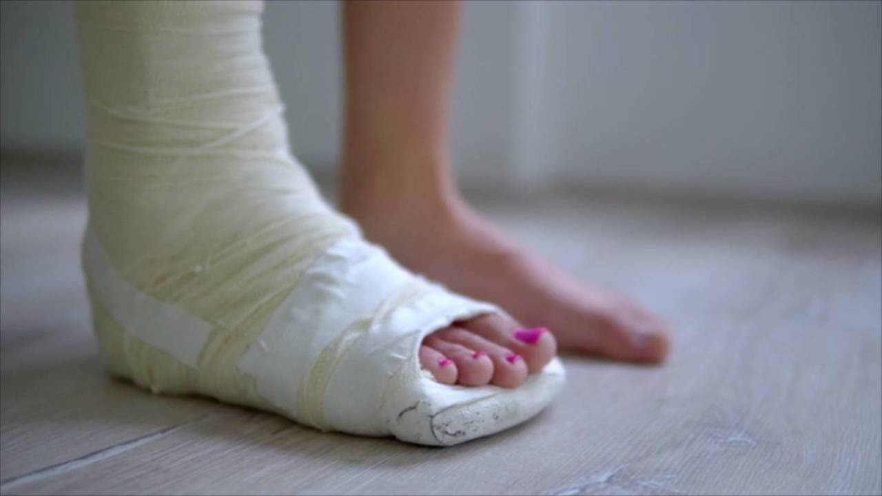 Erin Napier Shares Sweet Video of Daughter Helen Dancing Months After Breaking Leg in Scar