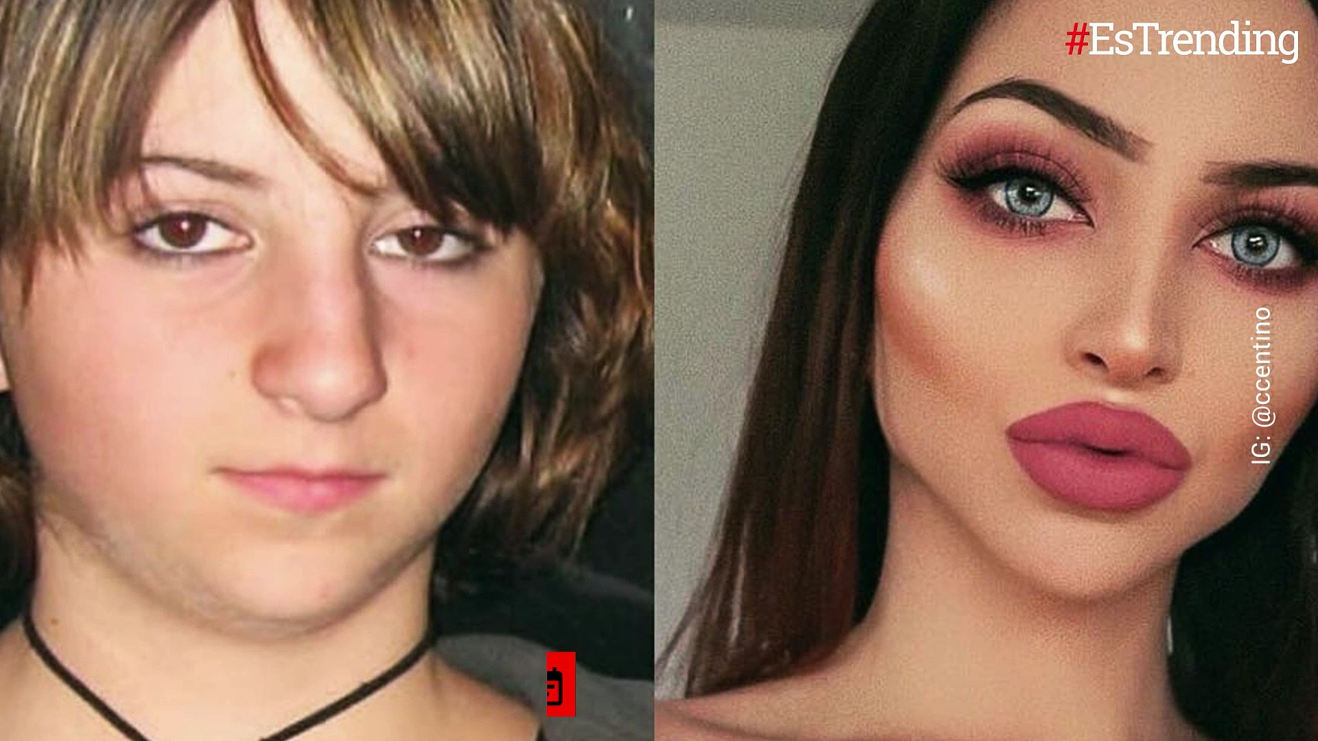 Sufrió matoneo cuando era joven y gastó una millonada para lucir diferente:  ahora triunfa en Instagram