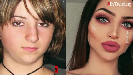 Sufrió matoneo cuando era joven y gastó una millonada para lucir diferente: ahora triunfa en Instagram