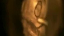 Baby in the womb!