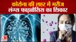 सावधान रहिए ! मरीज हो रहे Lung Fibrosis का शिकार | | Patients Suffering from Lungs Fibrosis