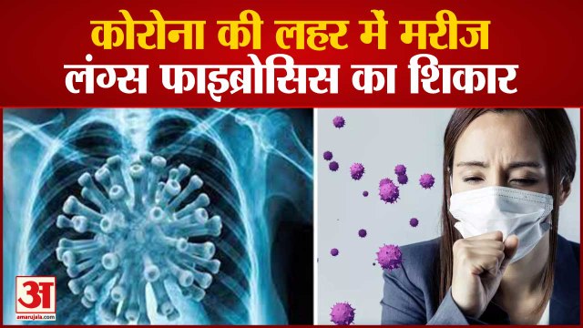 सावधान रहिए ! मरीज हो रहे Lung Fibrosis का शिकार | | Patients Suffering from Lungs Fibrosis