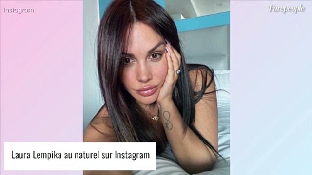 Laura Lempika blessée : gros bandage après un truc tout bête , elle raconte sa mésaventure