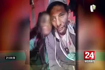 Vigilante se encuentra postrado en cama tras recibir brutal golpiza en SJL