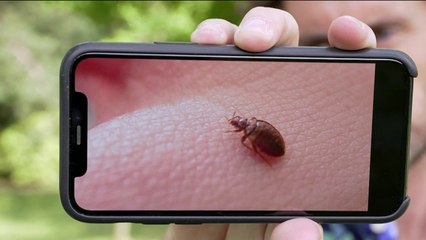 Santé - Tout sur les punaises de lit