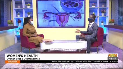 Women's Health: Ovarian Cyst and Dysmenorrhea- Badwam Afisem on Adom TV (15-7-21)