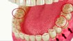 bd-causas-y-tratamientos-para-quebraduras-ydesgaste-dental-150721