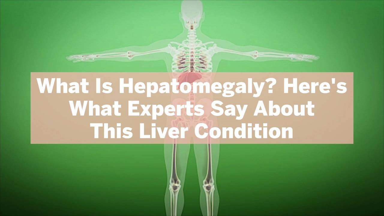 What Is Hepatomegaly? Here's What Experts Say About This Liver Condition