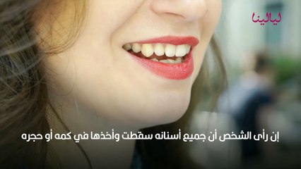 تفسير حلم سقوط الأسنان في اليد