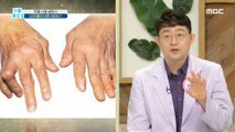 [HEALTHY] Why do I know my Knee Hurt? Rheumatoid arthritis., 기분 좋은 날 210716