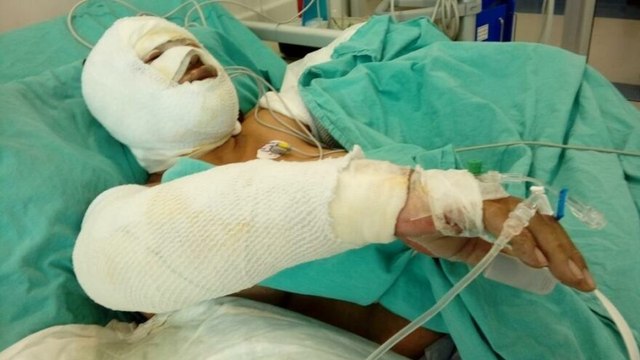 Eski kayınvalidesine benzin döktü, yanışını izledi