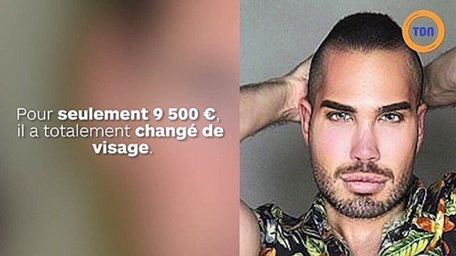 Ses opérations de chirurgie l’ont tellement métamorphosé que même son ex ne l’a pas reconnu et l’a de nouveau dragué