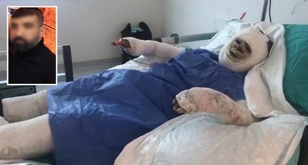 Damat dehşeti! Benzin döküp kayınvalidesini yaktı