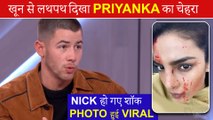 Priyanka Chopra Suffers SERIOUS Injuries  | Nick Jonas In Deep Tension ?