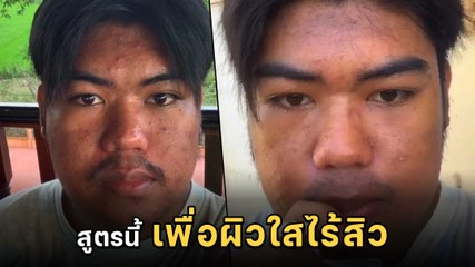 หนุ่มอยากเปลี่ยนแปลงตัวเอง รีวิวกินน้ำมะเขือเทศ 21 วัน อู้หูวว ไม่ใช่เล่นเลย