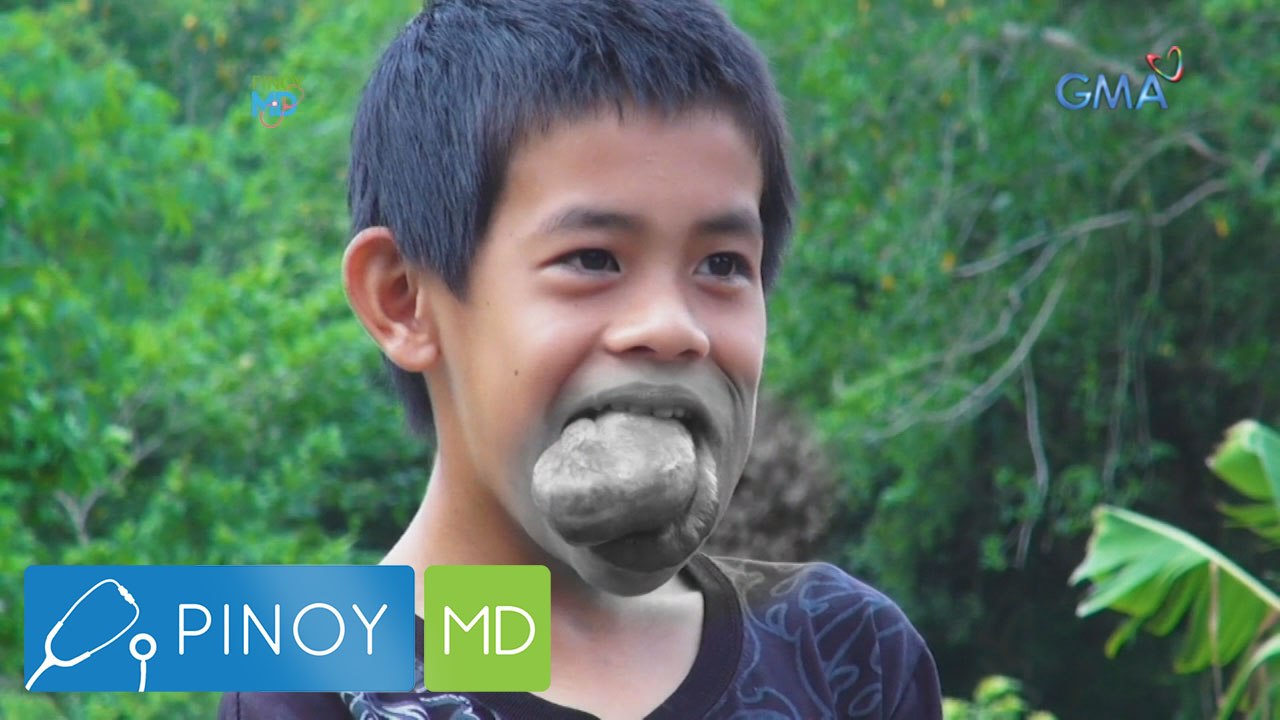 Pinoy MD: What is a vascular tumor?