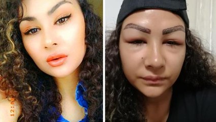 Ailesinden gizli reklam yüzü olmak isteyen 16 yaşındaki kız çocuğu, şimdi aynaya bakamıyor