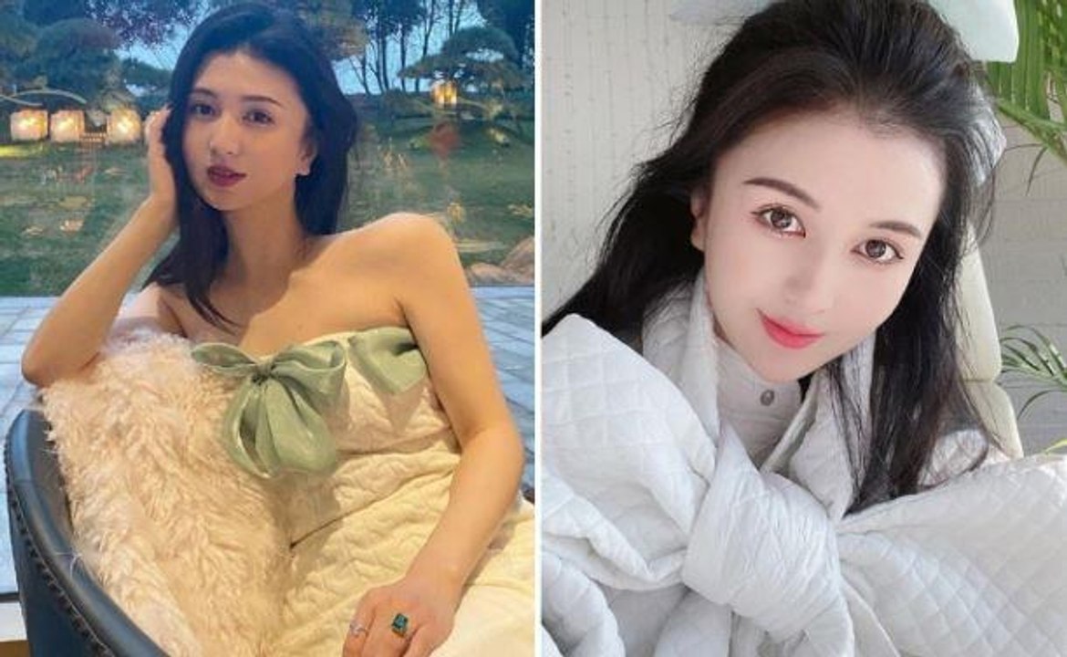 Güzel fenomenin acı sonu! Bir günde 3 estetik operasyonu geçirdikten sonra nefessiz kalarak can verdi