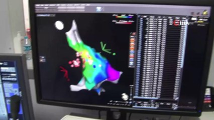 Kardiyoloji uzmanı açıkladı: Kalpte aritmi çözümsüz değil