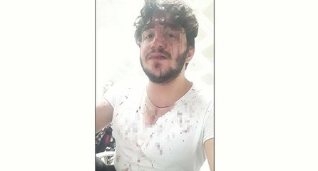 Ayrıldığı kız arkadaşı kabusu oldu