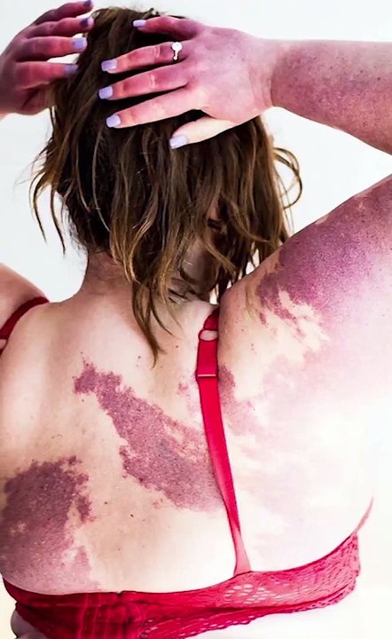 DECOMPLEXE.E - La fille qui a des tâches - TikTok