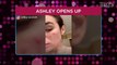 Pregnant Ashley Iaconetti Says Her 'Pregnancy Acne Hit Hard': 'I've Never Had Forehead Acne Before'