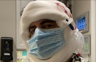 Marc Jacobs shares bandaged photo after facelift