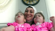 ANTALYA - Mutluluklarının adı Serebral Palsi hastası tek yumurta ikizi kızları oldu