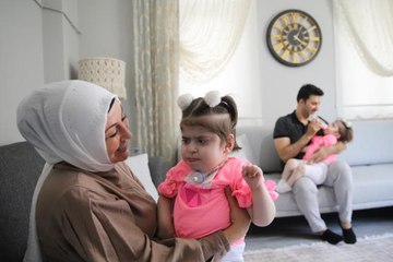 Mutluluklarının adı Serebral Palsi hastası tek yumurta ikizi kızları oldu
