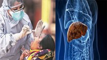 Corona Patient के  Liver में भर रहा पस, 3 Symptoms ALERT | Boldsky
