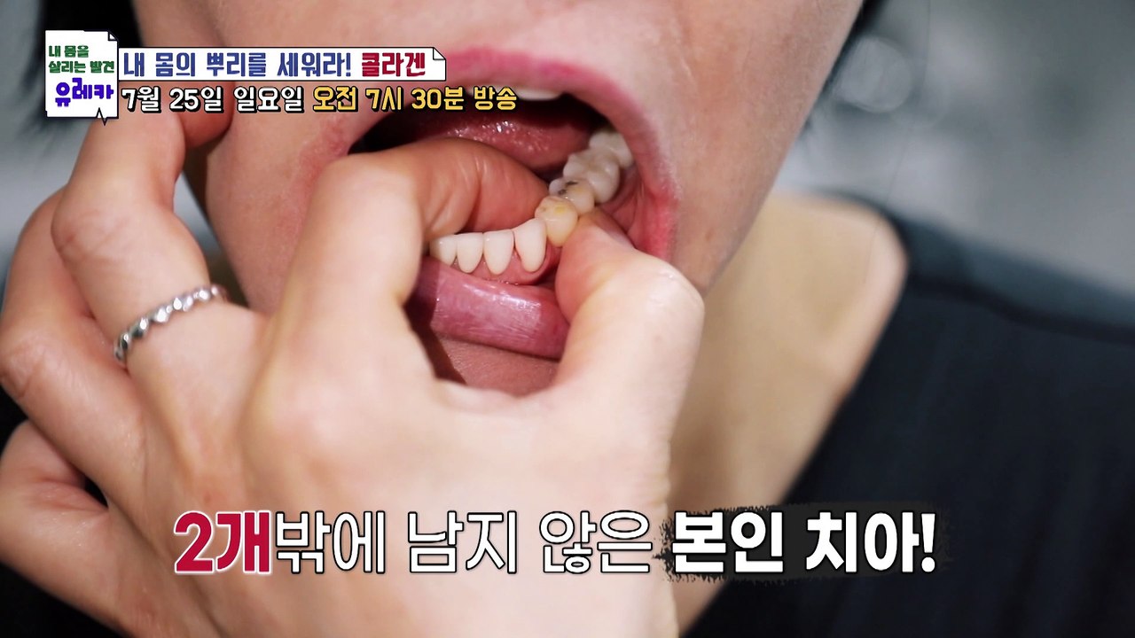 내 몸의 뿌리를 세워라! 콜라겐_새로운 발견 유레카 25회 예고 TV CHOSUN 2...