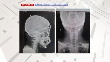 2 Masungi forest rangers, pinagbabaril ng hindi pa nakikilalang salarin; Iligal na aktibidad sa protected area, tinitignang anggulo | 24 Oras