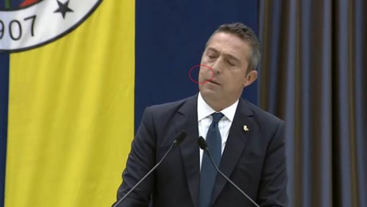 Sinek saldırısıyla kürsüde zor anlar yaşayan Ali Koç'un tepkileri gülmekten kırdı geçirdi