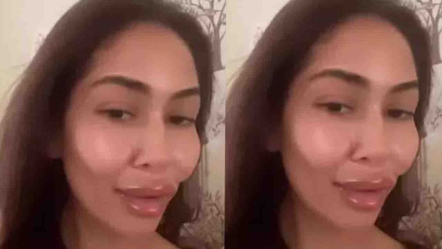 Shahid Kapoor की Wife Mira Rajput Kapoor ने Social Media पर Share की अपनी Cosmetic Surgery|FilmiBeat