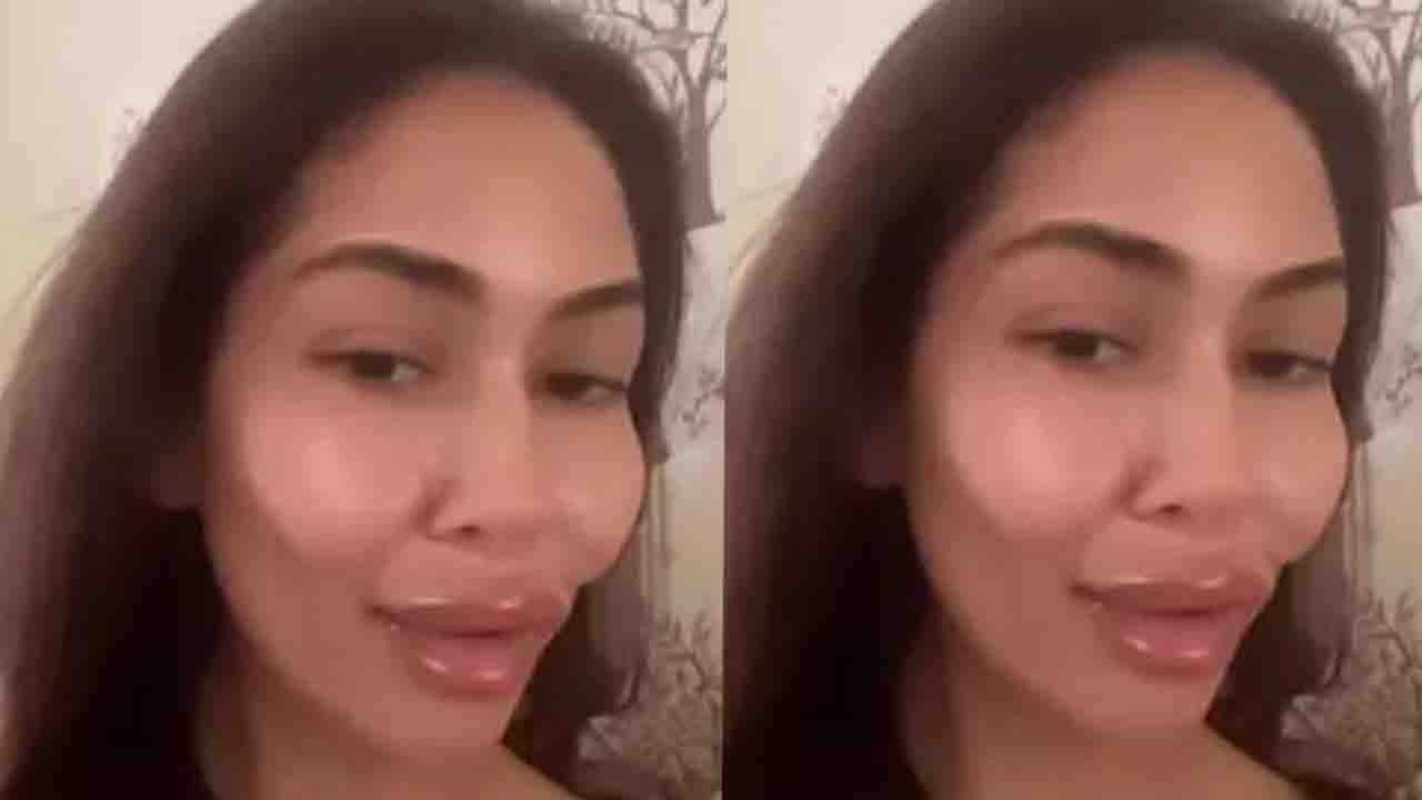Shahid Kapoor की Wife Mira Rajput Kapoor ने Social Media पर Share की अपनी Cosmetic Surgery|FilmiBeat