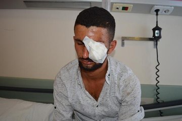 YERDE BULDUĞU HAVAİ FİŞEĞİN PATLAMASIYLA GÖZÜNDEN YARALANDI