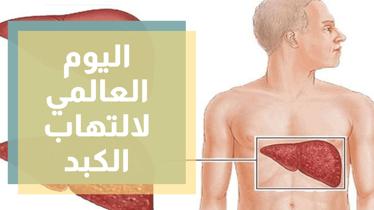 اليوم العالمي لالتهاب الكبد