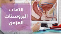 التهاب البروستات المزمن