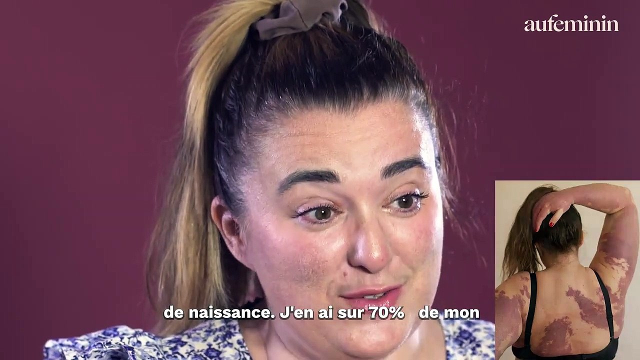 DECOMPLEXE.E - La fille qui a des taches YOUTUBE